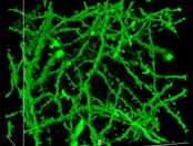 Swollen brain cells: scientists modified the superabsorbant nappy compound, polyacrylate, to magnify brain tissue. Credit: Courtesy of Boyden lab, Massachusetts Institute of Technology, Cambridge, Massachusetts, USA.