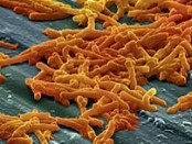 Clostridium difficile spores. Credit: Cjc2nd on Wikimedia commons.  Used under CC BY-SA 3.0 licence.